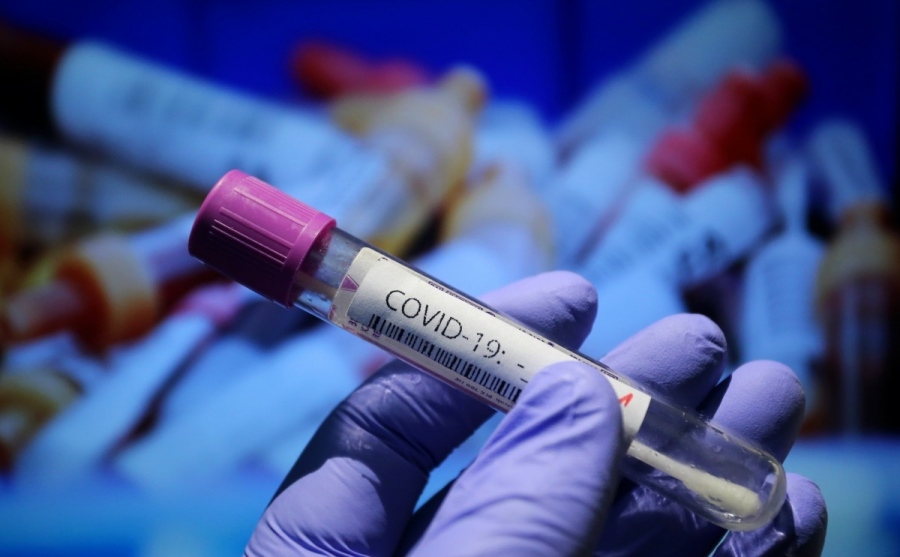 2517 нови случая на коронавирус при 15 297 теста